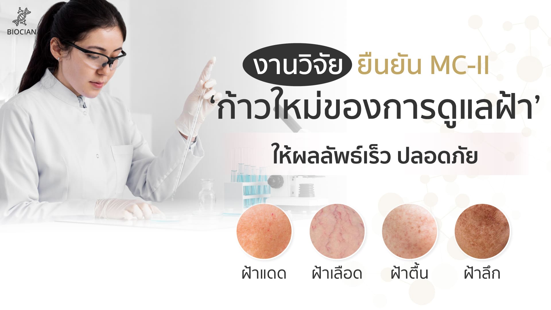  ทำไม กลไก MC-II™ (Melanin Control Complex II)  ถึงให้ผลลัพธ์ที่ยั่งยืนกว่าครีมลดฝ้าทั่วไป